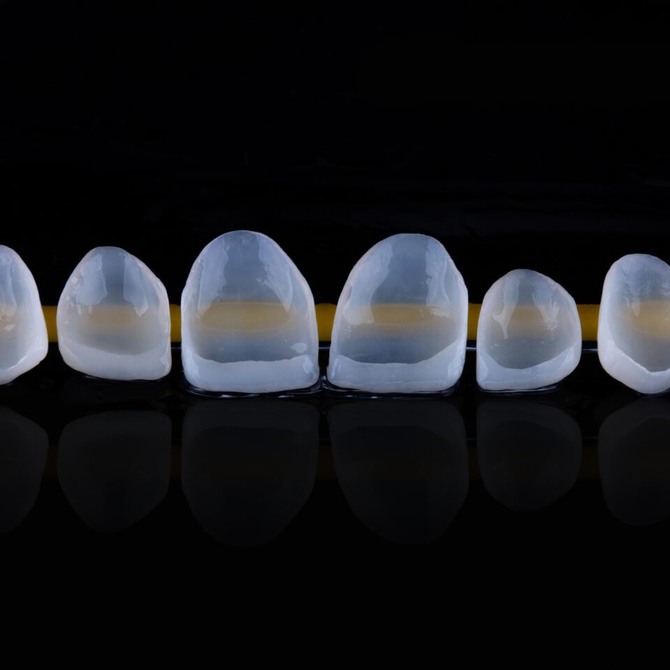 material lente de contato dental