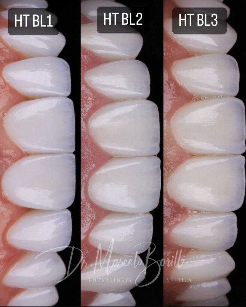 cor de lente de contato dental