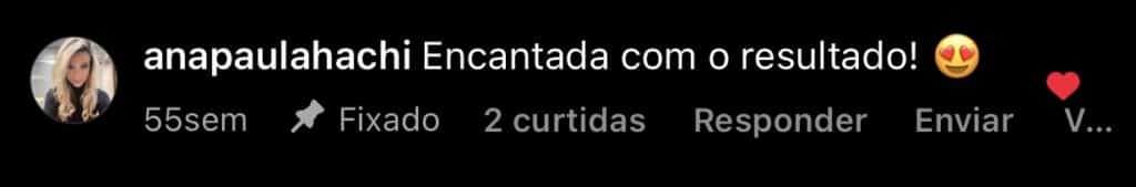 depoimento de lente de contato dental da Ana