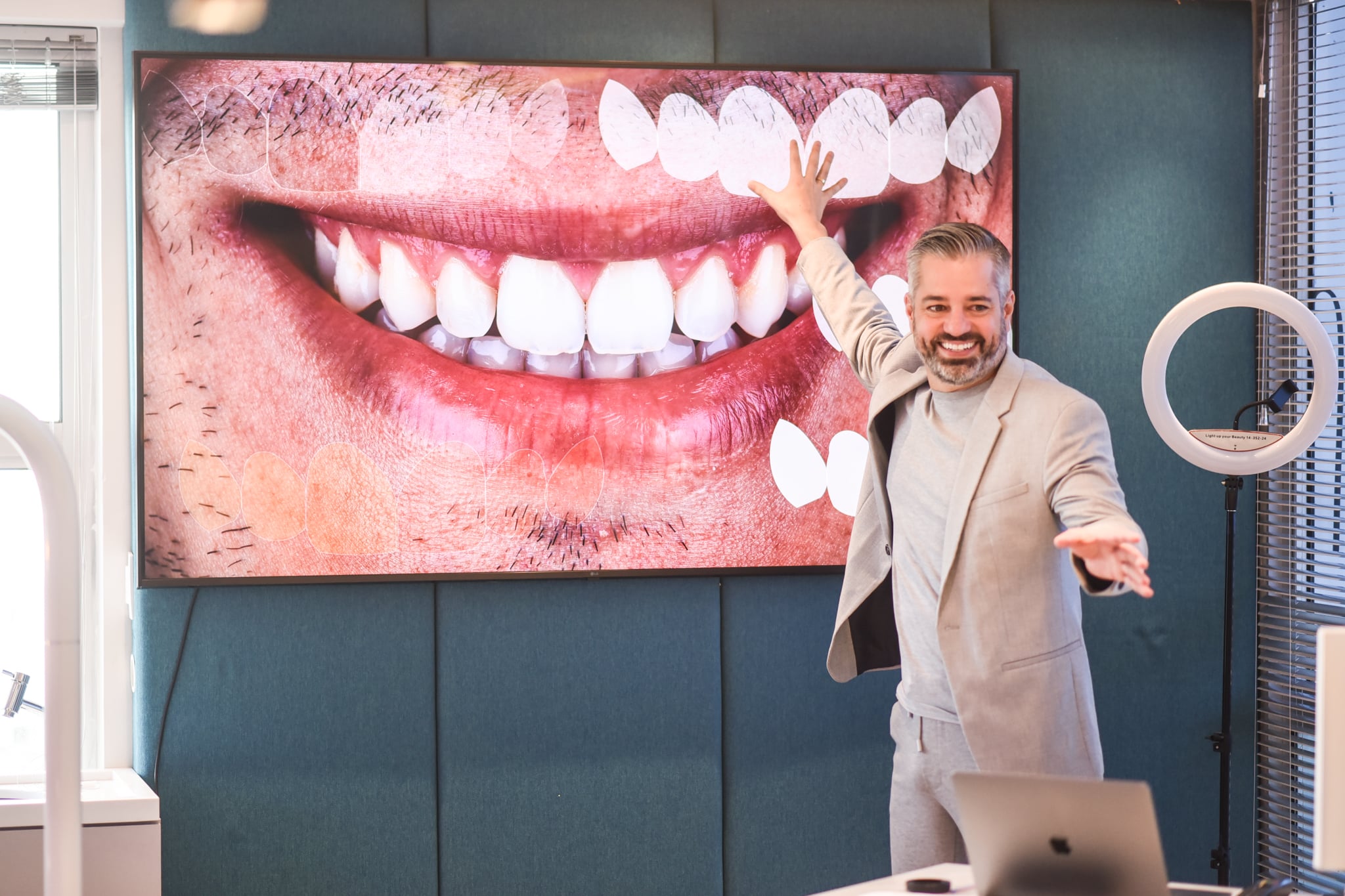 marcelo borille curso lente dental